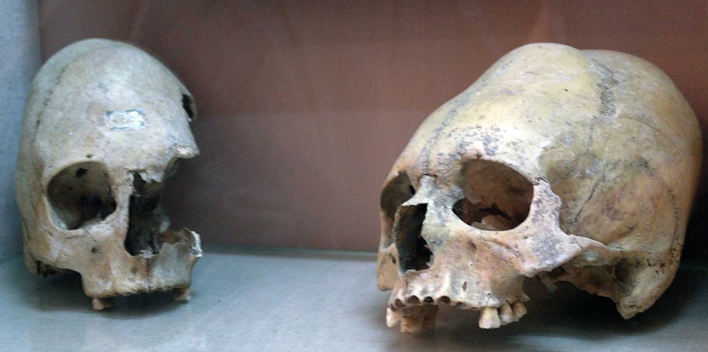 Деформированные черепа. Керченский музей-заповедник 